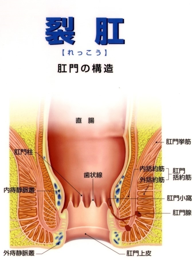 裂肛1.png